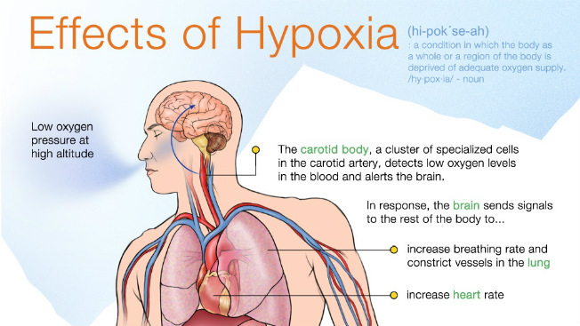 brain-hypoxia-oxygenation-prevention-and-treatment-veledora-fitness