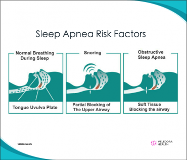 Prevention Techniques that Help Manage your Sleep Apnea!