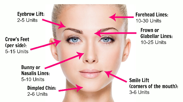 Botox Treatment, Benefits & Drawbacks! - Veledora health