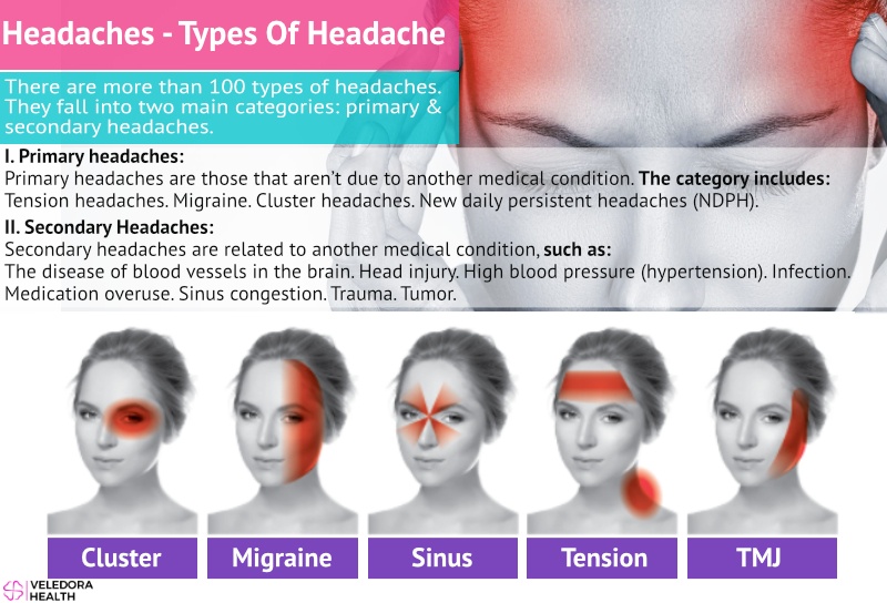 Frequent Headaches, Causes,Types And Treatments! - Veledora health