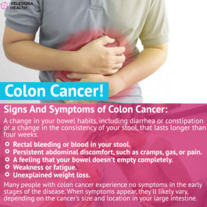 Colon Cancer Causes, Symptoms And Treatment! - Veledora health