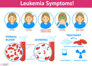 How Can You Identify Whether Your Child Has Leukemia?