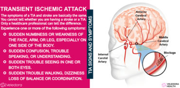 Transient Ischemic Attack (TIA) Warning Signs of Stroke! - Veledora health