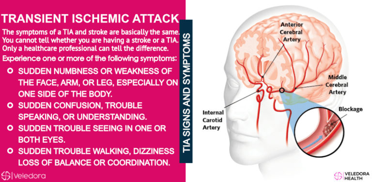 transient-ischemic-attack-tia-warning-signs-of-stroke-veledora-health