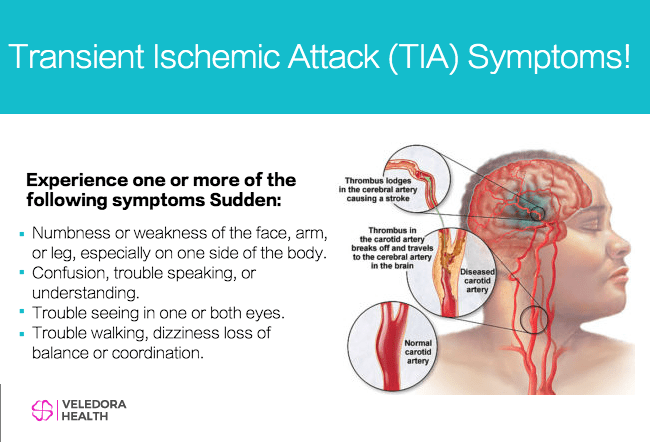 How Long To Recover From A Tia Stroke