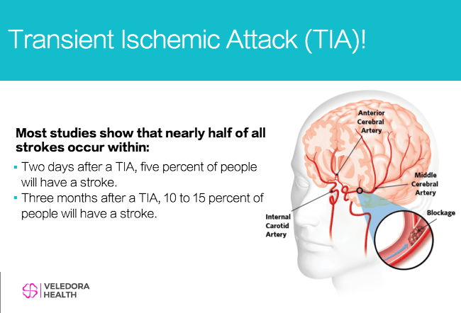 transient-ischemic-attack-tia-warning-signs-of-stroke-veledora-health