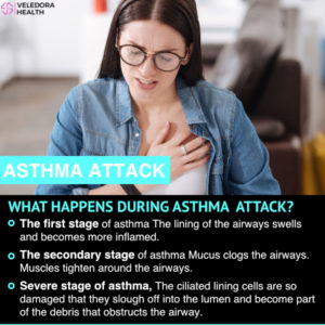 Asthma Disease, How to Reduce Asthma Triggers?