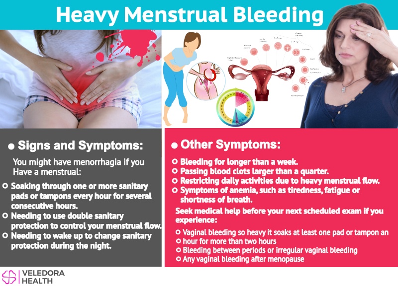 Heavy Menstrual Bleeding Causes And Treatment 9720