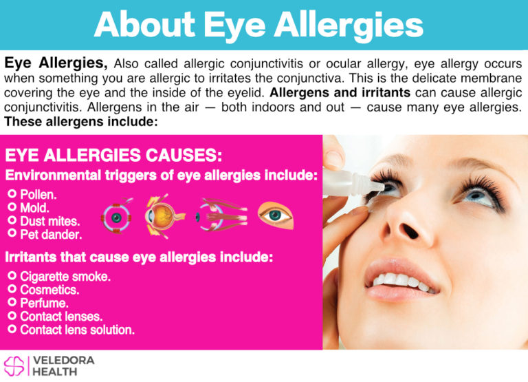 Eye Allergies Treatment Options And Management 