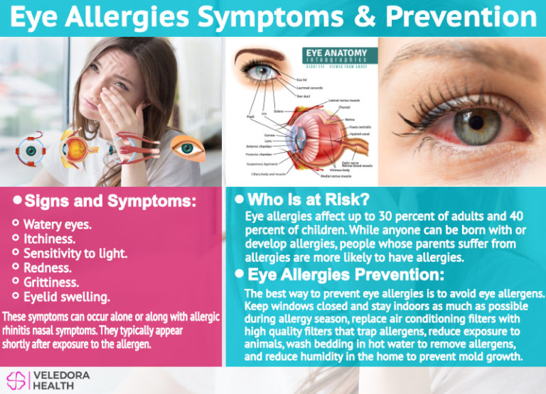 Eye Allergies Types Symptoms Causes And Treatment – NBKomputer