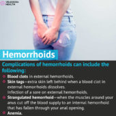 Hemorrhoids, Causes, Symptoms And Treatment!