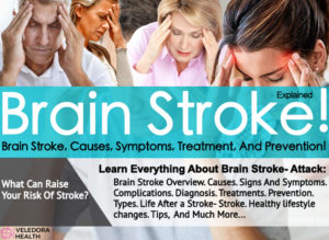 Brain Stroke, How to Prevent Brain Stroke! - Veledora health