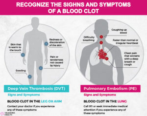 Blood Clots, Risks, Symptoms And Prevention! - Veledora Health